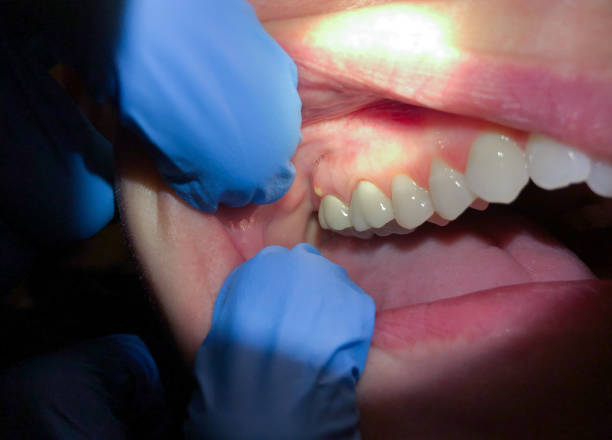 Best Emergency Treatment for Jaw Pain or Injury in Grant, MN