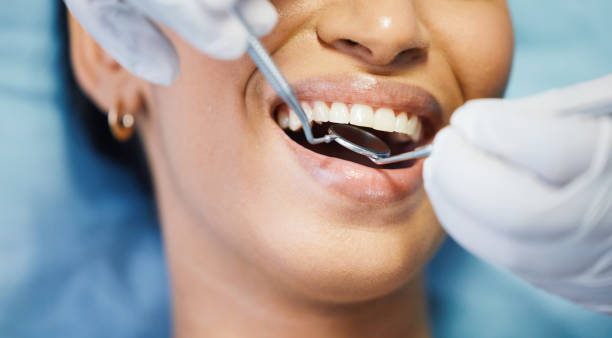 Best Dental Abscess Treatment in Grant, MN