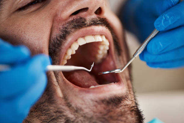 Best Emergency Dental Care for Sports Injuries in Grant, MN